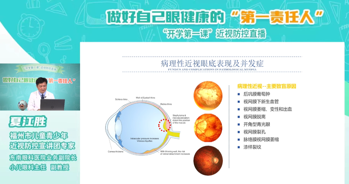 福州科技館眼健康分館開(kāi)展做好自己眼健康的“第一責(zé)任人”開(kāi)學(xué)第一課近視防控直播